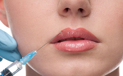 revanesse lips injections