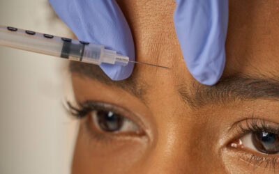 What Is the Difference Between Botox and Dysport?