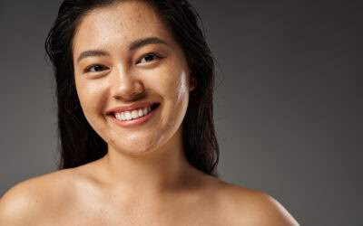 Morpheus8 vs. SkinPen Microneedling: Which One Fits You Best?