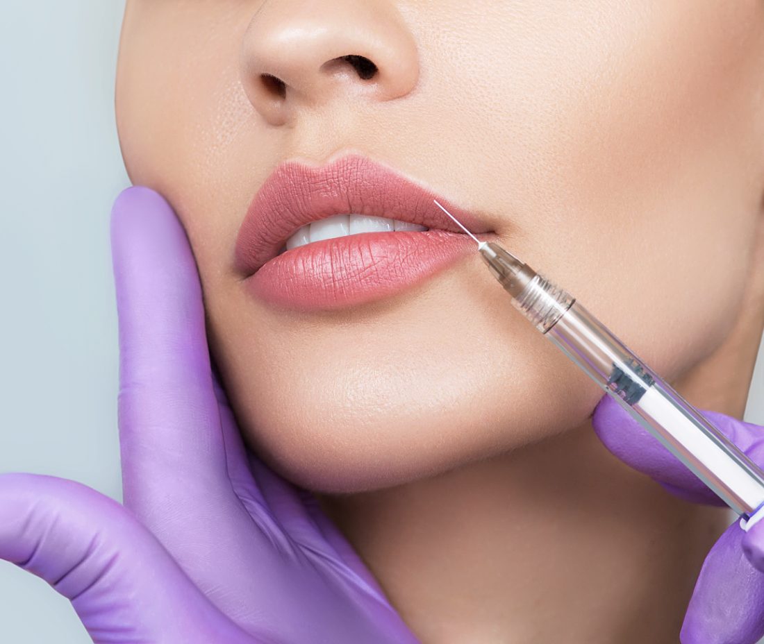 revanesse lips injections